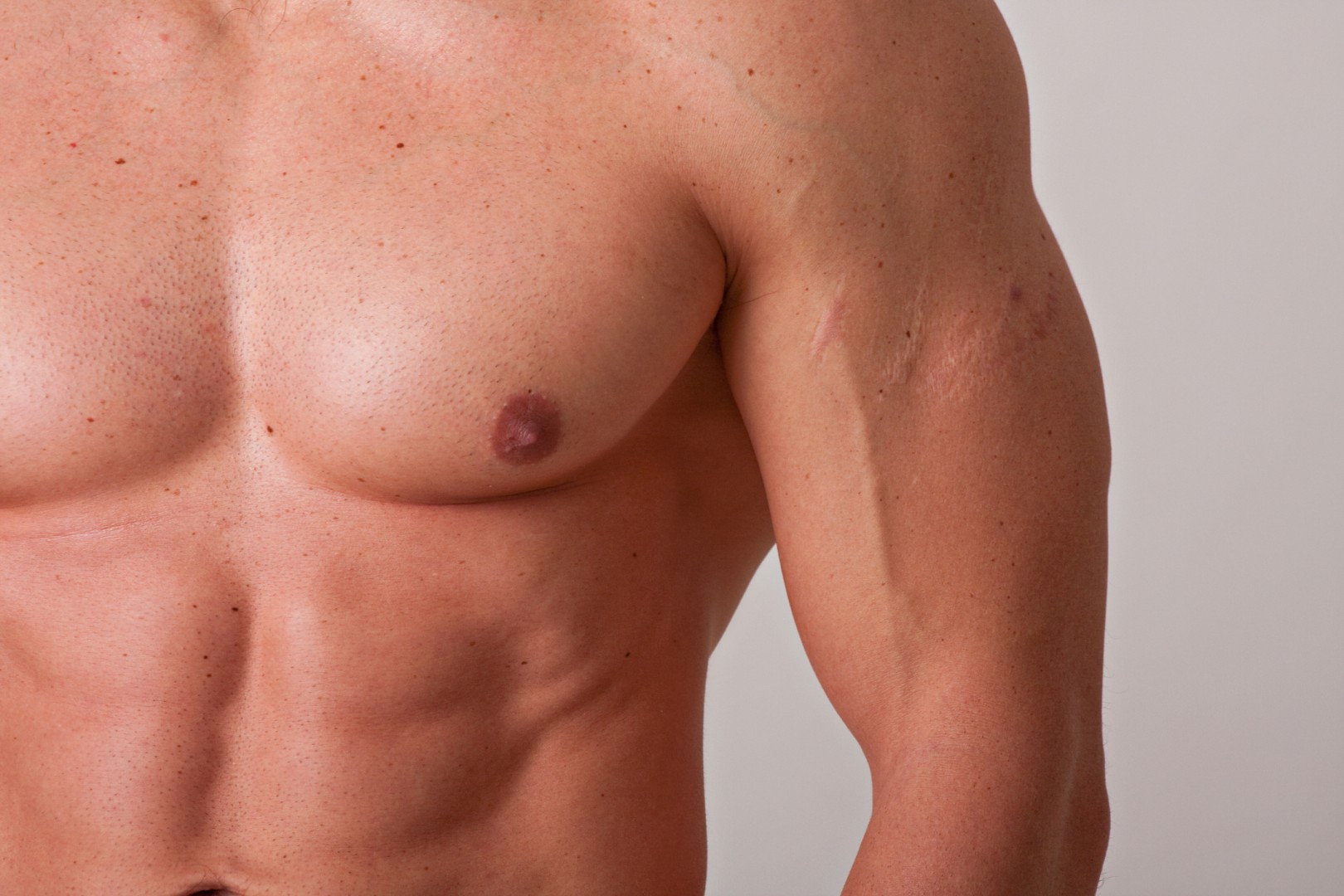 Male chest correction